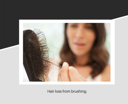 Hair loss from brushing