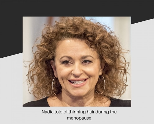 Nadia talking about thinning hair