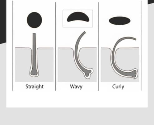 The three different hair follicle shapes as a diagram