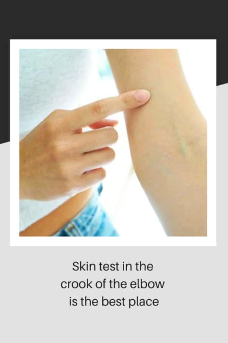 Picture showing crook of the elbow is the bets place for a skin test