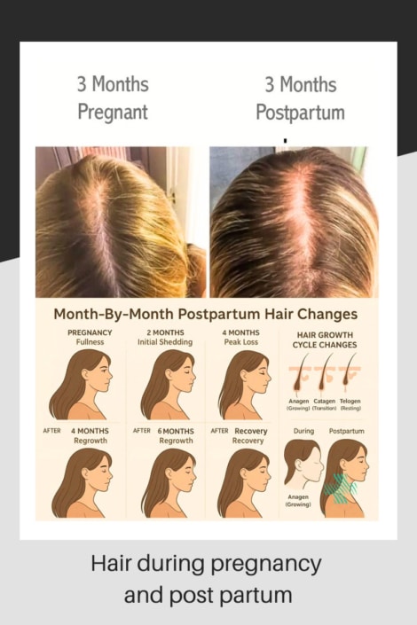 Diagram and pictures showing hair changes during pregnancy and postpartum