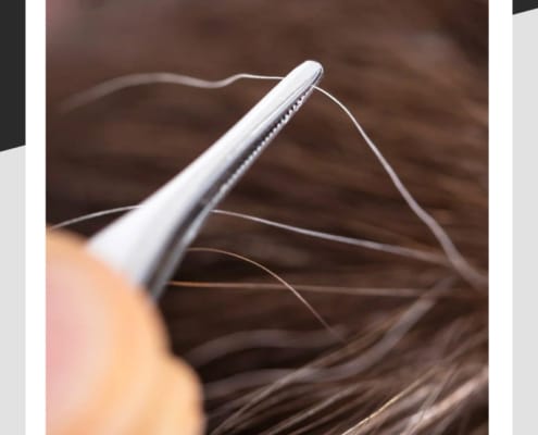 Tweezers pulling grey hair from head